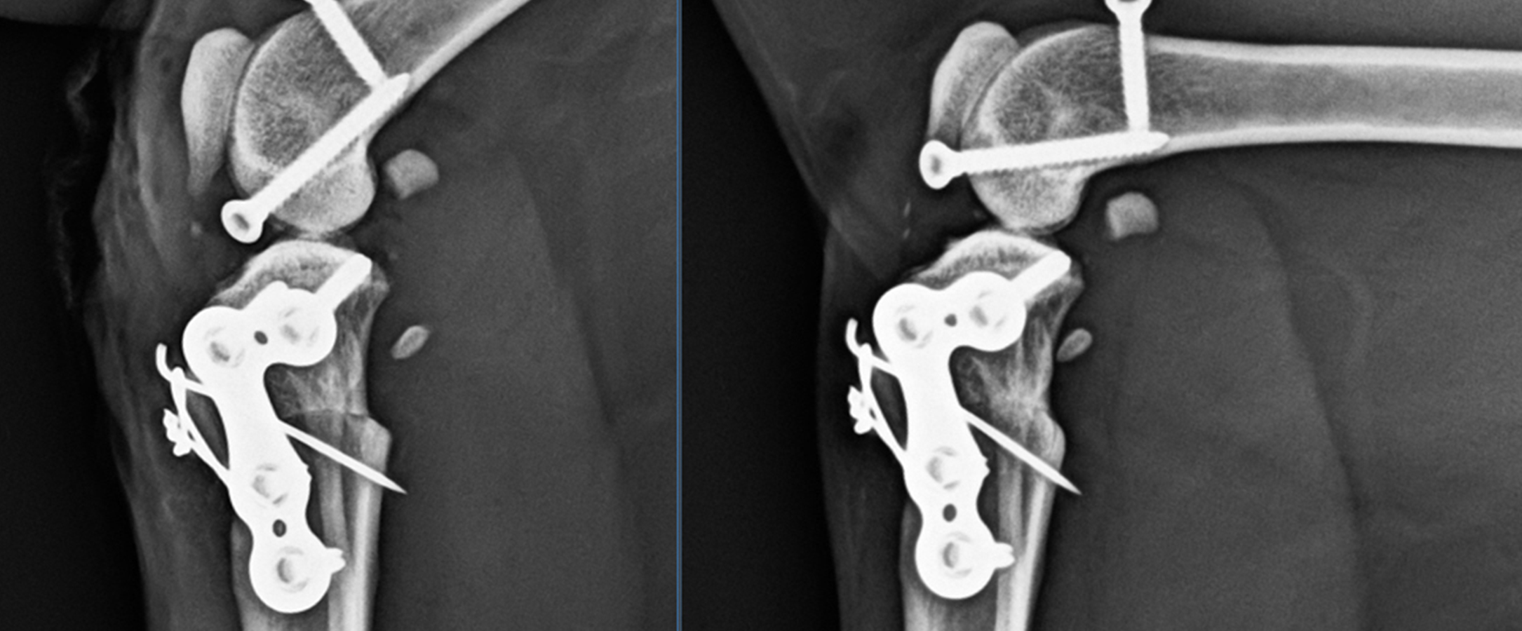 Orthopädische Implantatplanung