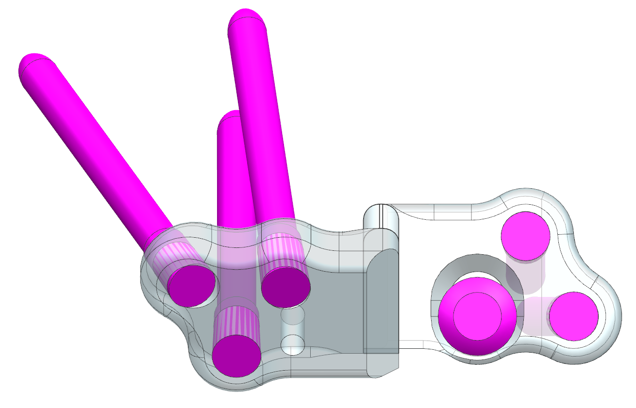 3D-Planung eines chirurgischen Implantats