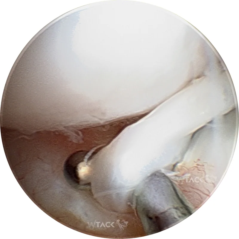 Minimal Invasive Chirurgie Galerie Bild 4