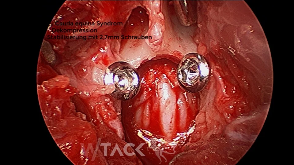 Neuro-Chirurgie Galerie Bild 6